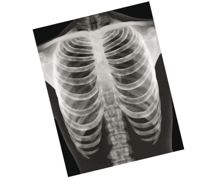 Röntgen Beelden Mens